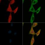 Phospho-STXBP1 (Ser313) Antibody in Immunocytochemistry (ICC/IF)