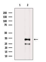 Phospho-PP2A alpha (Tyr307) Antibody in Western Blot (WB)