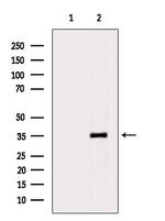 Phospho-PP2A alpha (Tyr307) Antibody in Western Blot (WB)