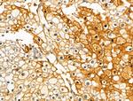 Phospho-PKC delta (Ser645) Antibody in Immunohistochemistry (Paraffin) (IHC (P))