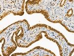 Phospho-PKC delta (Ser645) Antibody in Immunohistochemistry (Paraffin) (IHC (P))