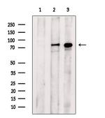 Phospho-PKC delta (Ser645) Antibody in Western Blot (WB)