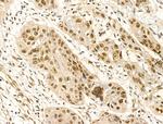 Phospho-FOXM1 (Ser35) Antibody in Immunohistochemistry (Paraffin) (IHC (P))