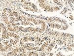 Phospho-FOXM1 (Ser35) Antibody in Immunohistochemistry (Paraffin) (IHC (P))