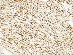 Phospho-FOXM1 (Ser35) Antibody in Immunohistochemistry (Paraffin) (IHC (P))