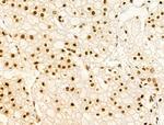 Phospho-FOXM1 (Ser35) Antibody in Immunohistochemistry (Paraffin) (IHC (P))