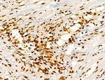 Phospho-FOXM1 (Ser35) Antibody in Immunohistochemistry (Paraffin) (IHC (P))