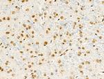 Phospho-FOXM1 (Ser35) Antibody in Immunohistochemistry (Paraffin) (IHC (P))