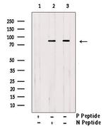 Phospho-FOXM1 (Ser35) Antibody in Western Blot (WB)