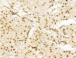 Phospho-PAK1/PAK2 (Thr423, Thr402) Antibody in Immunohistochemistry (Paraffin) (IHC (P))