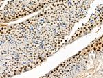 Phospho-PAK1/PAK2 (Thr423, Thr402) Antibody in Immunohistochemistry (Paraffin) (IHC (P))