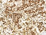 Phospho-PPIG (Ser376) Antibody in Immunohistochemistry (Paraffin) (IHC (P))