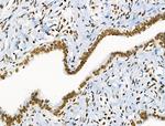 Phospho-BRK (Tyr447) Antibody in Immunohistochemistry (Paraffin) (IHC (P))