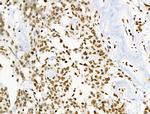 Phospho-BRK (Tyr447) Antibody in Immunohistochemistry (Paraffin) (IHC (P))