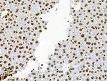 Phospho-BRK (Tyr447) Antibody in Immunohistochemistry (Paraffin) (IHC (P))