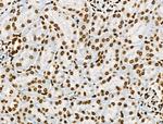 Phospho-BRK (Tyr447) Antibody in Immunohistochemistry (Paraffin) (IHC (P))