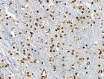 Phospho-BRK (Tyr447) Antibody in Immunohistochemistry (Paraffin) (IHC (P))