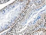 Phospho-BRK (Tyr447) Antibody in Immunohistochemistry (Paraffin) (IHC (P))