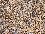 Phospho-BRK (Tyr447) Antibody in Immunohistochemistry (Paraffin) (IHC (P))