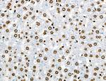 Phospho-BRK (Tyr447) Antibody in Immunohistochemistry (Paraffin) (IHC (P))