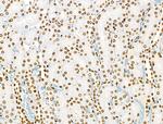 Phospho-BRK (Tyr447) Antibody in Immunohistochemistry (Paraffin) (IHC (P))