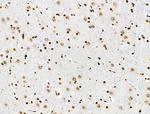 Phospho-BRK (Tyr447) Antibody in Immunohistochemistry (Paraffin) (IHC (P))