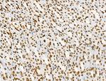 Phospho-BRK (Tyr447) Antibody in Immunohistochemistry (Paraffin) (IHC (P))