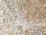 Phospho-BRK (Tyr447) Antibody in Immunohistochemistry (Paraffin) (IHC (P))