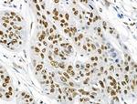 Phospho-BRK (Tyr447) Antibody in Immunohistochemistry (Paraffin) (IHC (P))