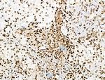 Phospho-BRK (Tyr447) Antibody in Immunohistochemistry (Paraffin) (IHC (P))