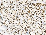 Phospho-BRK (Tyr447) Antibody in Immunohistochemistry (Paraffin) (IHC (P))