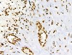 Phospho-BRK (Tyr447) Antibody in Immunohistochemistry (Paraffin) (IHC (P))