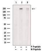 Phospho-SCRIB (Ser1220) Antibody in Western Blot (WB)