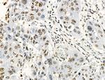 Phospho-GIT2 (Tyr592) Antibody in Immunohistochemistry (Paraffin) (IHC (P))