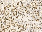 Phospho-GIT2 (Tyr592) Antibody in Immunohistochemistry (Paraffin) (IHC (P))