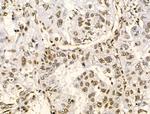 Phospho-GIT2 (Tyr592) Antibody in Immunohistochemistry (Paraffin) (IHC (P))