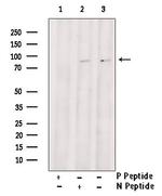 Phospho-GIT2 (Tyr592) Antibody in Western Blot (WB)