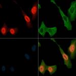 Phospho-RSK1 (Thr573) Antibody in Immunocytochemistry (ICC/IF)