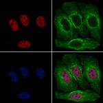 Phospho-RSK1 (Thr573) Antibody in Immunocytochemistry (ICC/IF)