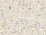 Phospho-RSK1 (Thr573) Antibody in Immunohistochemistry (Paraffin) (IHC (P))