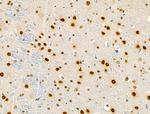 Phospho-RSK1 (Thr573) Antibody in Immunohistochemistry (Paraffin) (IHC (P))