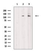 Phospho-GEF-H1 (Ser886) Antibody in Western Blot (WB)