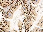 Phospho-MNK1 (Thr250, Thr255) Antibody in Immunohistochemistry (Paraffin) (IHC (P))