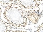 Phospho-NUDC (Ser326) Antibody in Immunohistochemistry (Paraffin) (IHC (P))