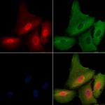 Phospho-ATF6 (Thr166) Antibody in Immunocytochemistry (ICC/IF)