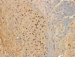 Phospho-ATF6 (Thr166) Antibody in Immunohistochemistry (Paraffin) (IHC (P))