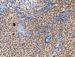 Phospho-ATF6 (Thr166) Antibody in Immunohistochemistry (Paraffin) (IHC (P))