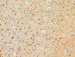 Phospho-ATF6 (Thr166) Antibody in Immunohistochemistry (Paraffin) (IHC (P))