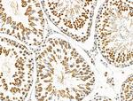 Phospho-ATF6 (Thr166) Antibody in Immunohistochemistry (Paraffin) (IHC (P))