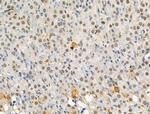 Phospho-ATF6 (Thr166) Antibody in Immunohistochemistry (Paraffin) (IHC (P))